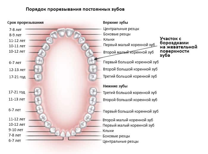 Dental Sealants