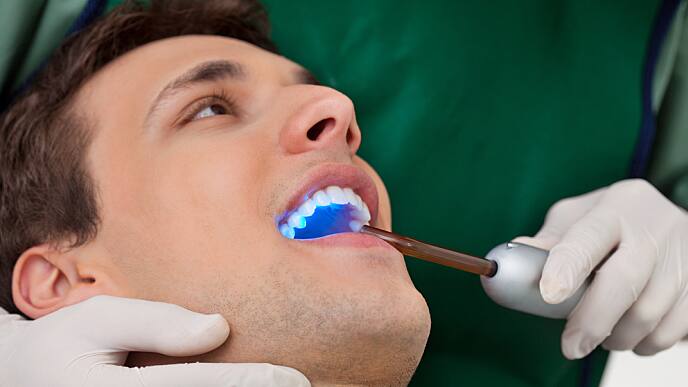 Стоматологический герметик для зубов